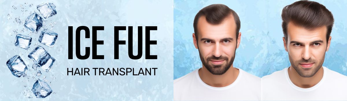 hair-transplant-in-karach-dr-irfan-clinics